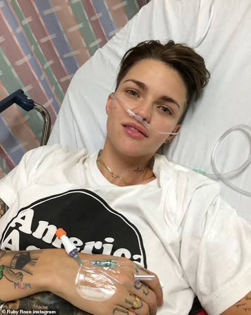 ruby rose accident